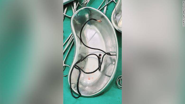 Pene cargador de celular cirugia22 1