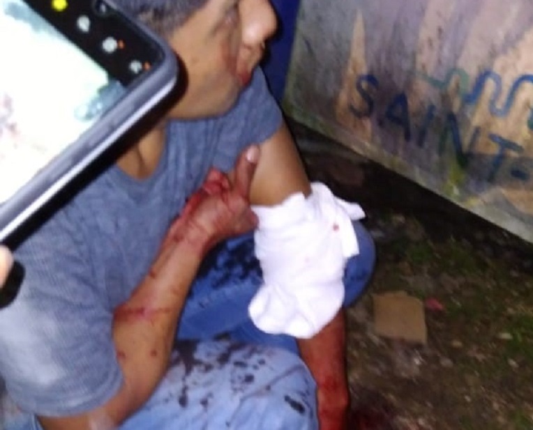 Macheteado
