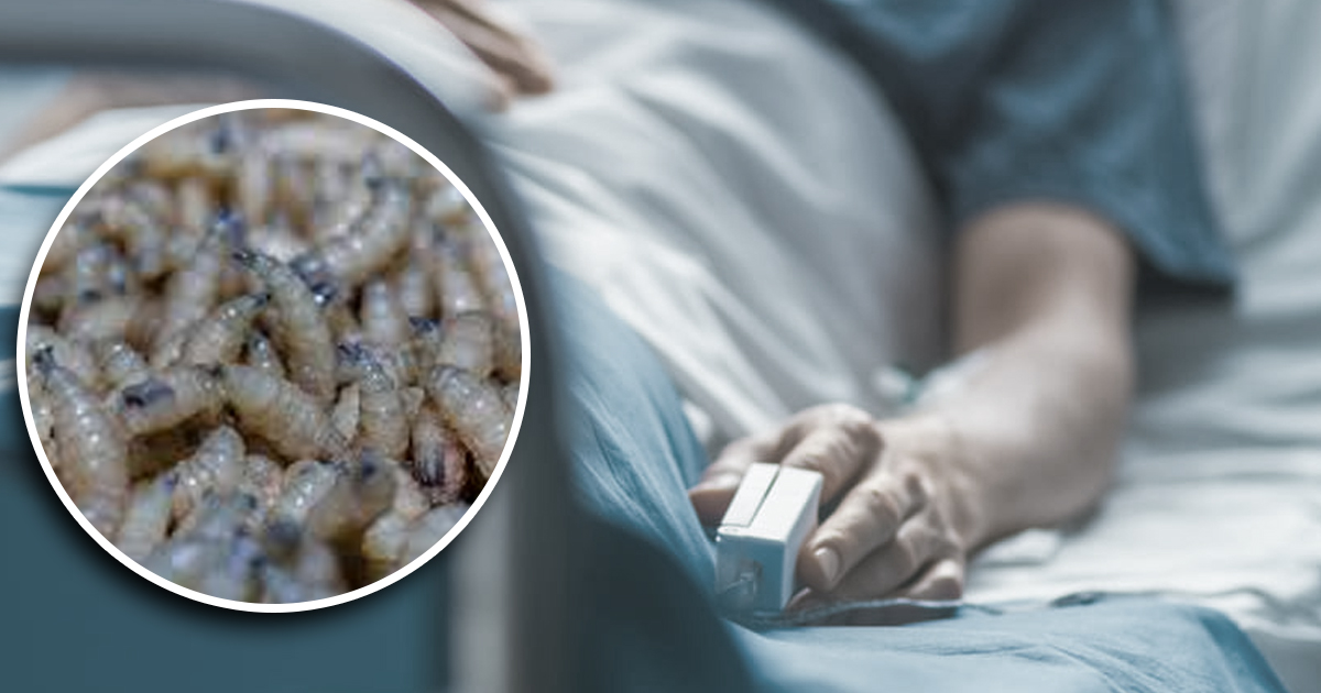 Gusano humano